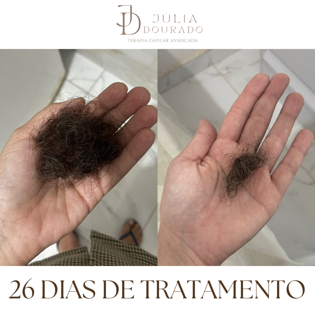 Beige Minimalist Skincare Before and After Instagram Post(1)