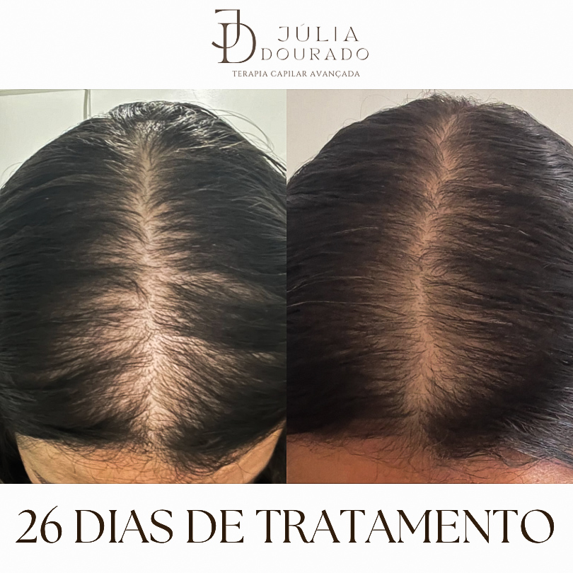 Beige Minimalist Skincare Before and After Instagram Post(1)